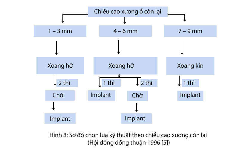 Nâng xoang hàm, ghép xương và cấy ghép implant