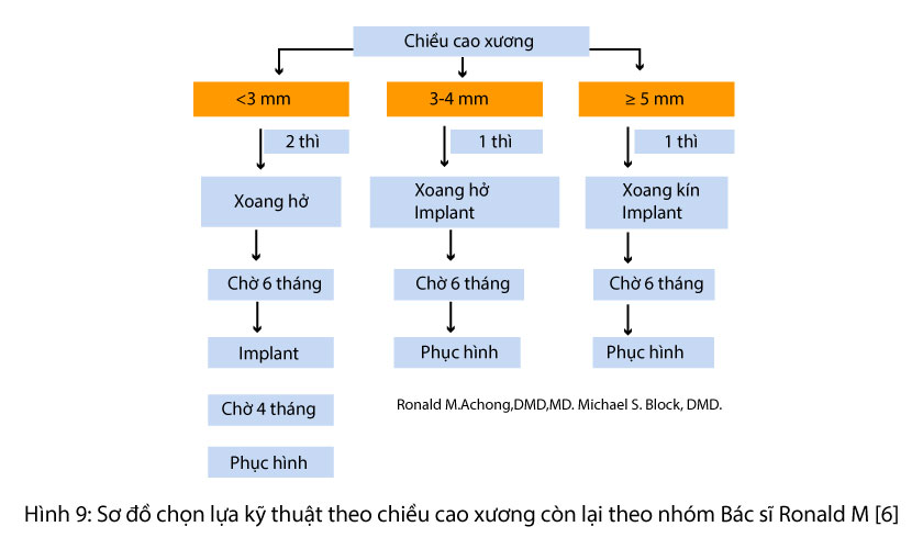 Nâng xoang hàm, ghép xương và cấy ghép implant