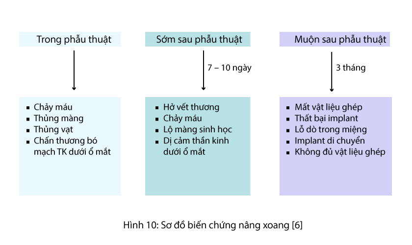 Nâng xoang hàm, ghép xương và cấy ghép implant
