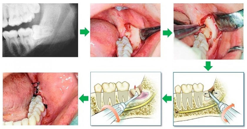 nho-rang-khon-uy-tin-tai-quan-10