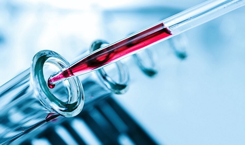 nho-rang-khon-uy-tin-tai-quan-10