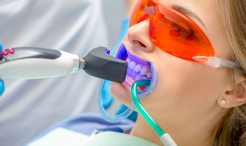 Tẩy trắng răng Laser Whitening tại phòng khám nha khoa