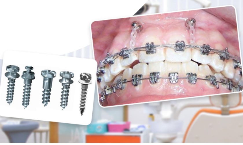 dia-chi-nieng-rang-uy-tin