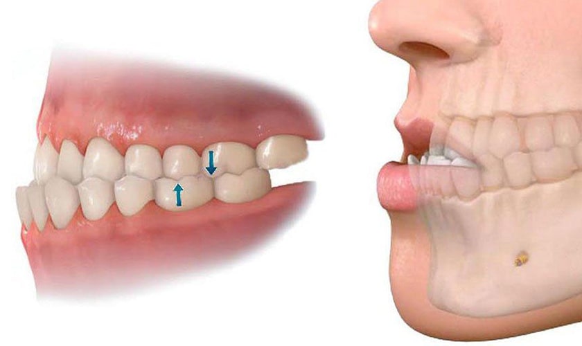 nha-khoa-nieng-rang-uy-tin-quan-3