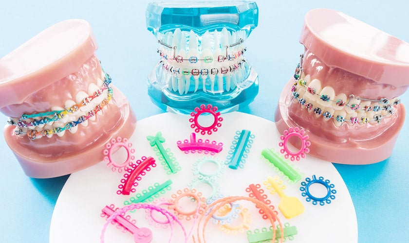 trung-tam-nieng-rang-gia-re-sai-gon