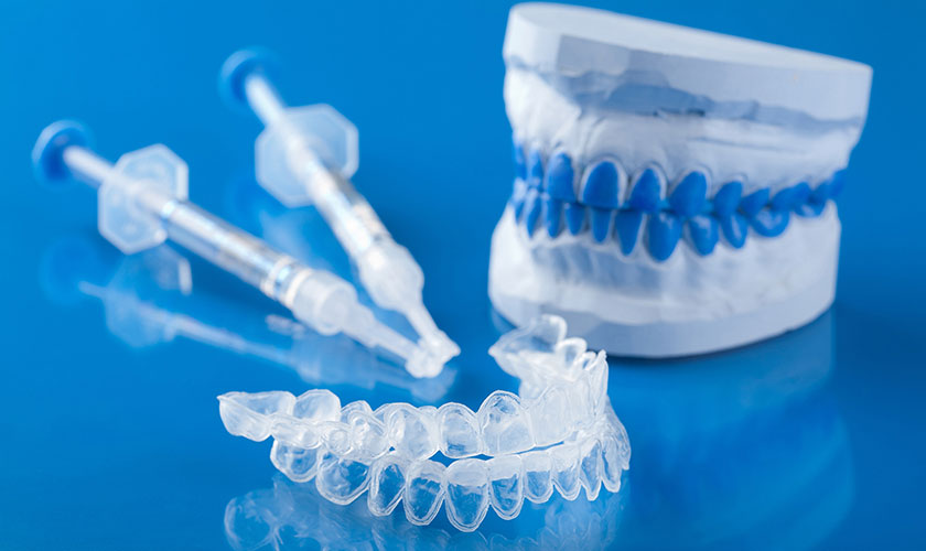 Tẩy trắng răng bằng máng và thuốc tẩy là phương pháp được nhiều người ưa chuộng