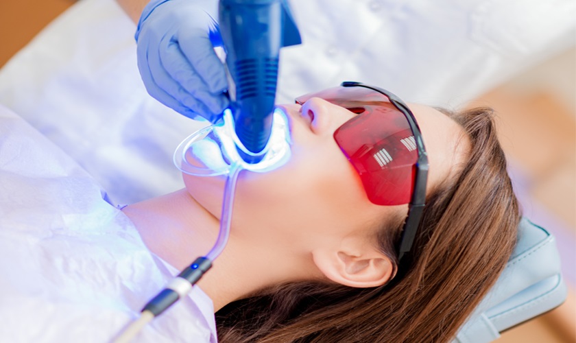 Tẩy trắng răng tại nha khoa giúp bạn tiết kiệm thời gian