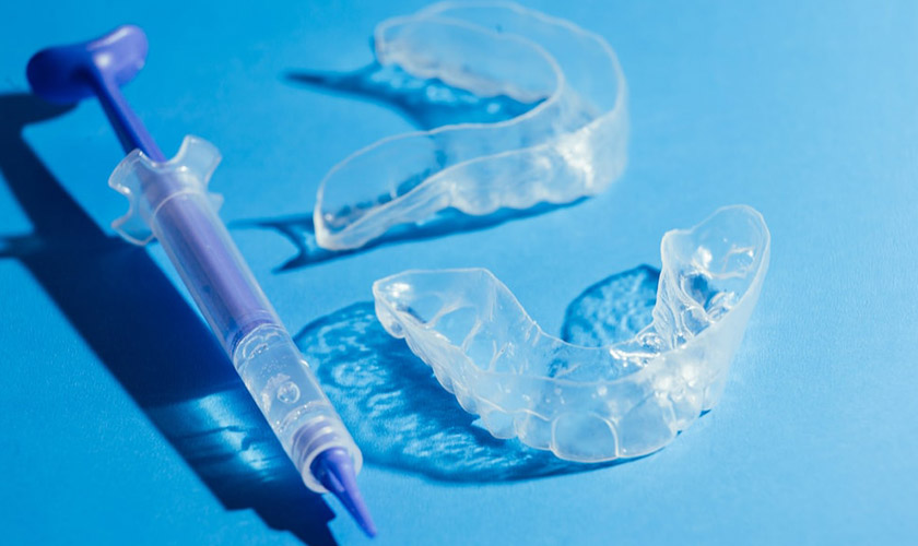Tẩy trắng răng bằng cách đeo máng tại nhà