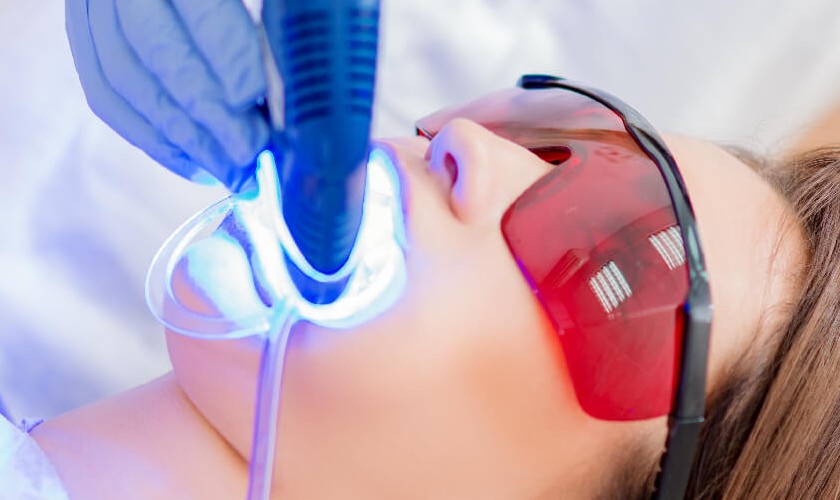 Nha khoa Nhân Tâm sử dụng nghệ tẩy trắng răng Laser Whitening hiện đại