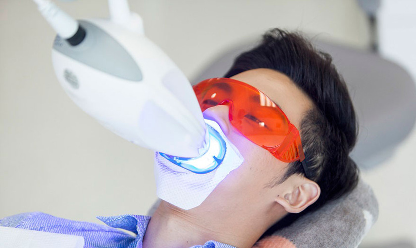 Tẩy trắng răng Laser Whitening là công nghệ được đánh giá cao nhất hiện nay Tẩy trắng răng Laser Whitening là công nghệ được đánh giá cao nhất hiện nay