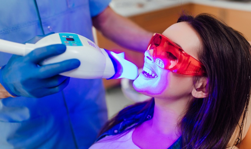 Tẩy trắng răng bằng công nghệ Laser Whitening có chi phí cao hơn tẩy trắng răng bằng máng tại nhà Tẩy trắng răng bằng công nghệ Laser Whitening có chi phí cao hơn tẩy trắng răng bằng máng tại nhà