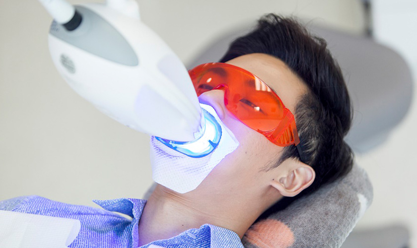 Laser Whitening là công nghệ tẩy trắng răng được đánh giá cao nhất hiện nay