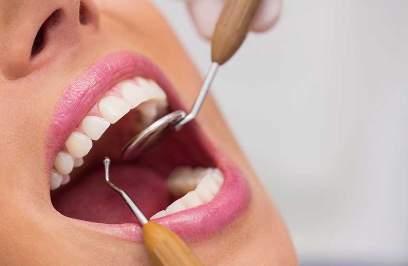 Vôi răng tăng nguy cơ các bệnh lý về răng miệng