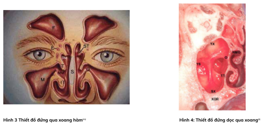 Kết quả giải phẫu, sinh lý xoang hàm