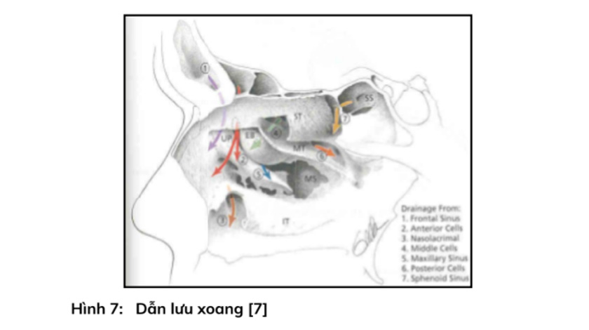 Dẫn lưu xoang