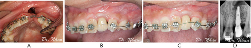 DescriptionDescription