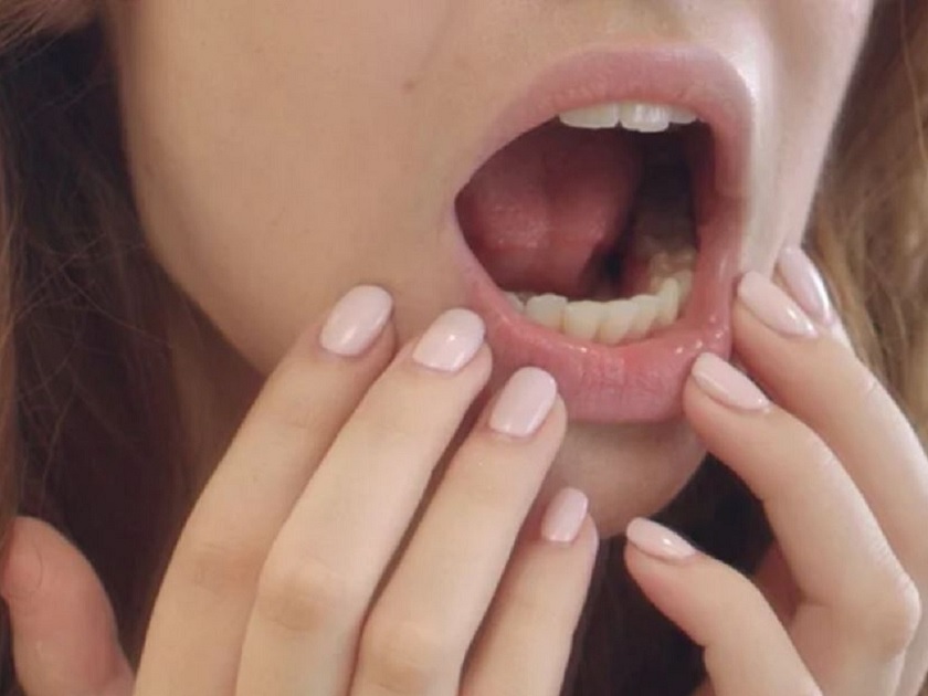 Mòn mặt nhai có thể làm giảm khả năng tiết nước bọt khi ăn uống, từ đó gây khô miệng