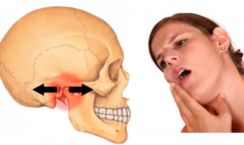 Đau răng cũng có thể là dấu hiệu của những bệnh toàn thân khác Đau răng cũng có thể là dấu hiệu của những bệnh toàn thân khác