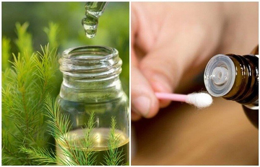 Giảm đau răng hàm bằng tinh dầu