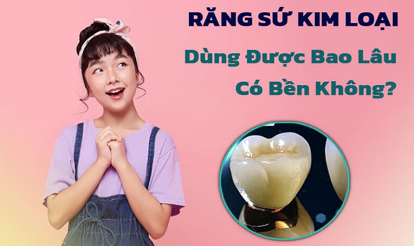 1. Giới thiệu về răng sứ kim loại