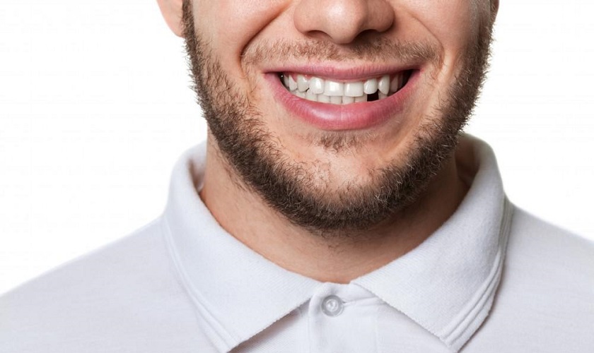 Chọn phương pháp trồng răng sứ phù hợp với tình trạng răng