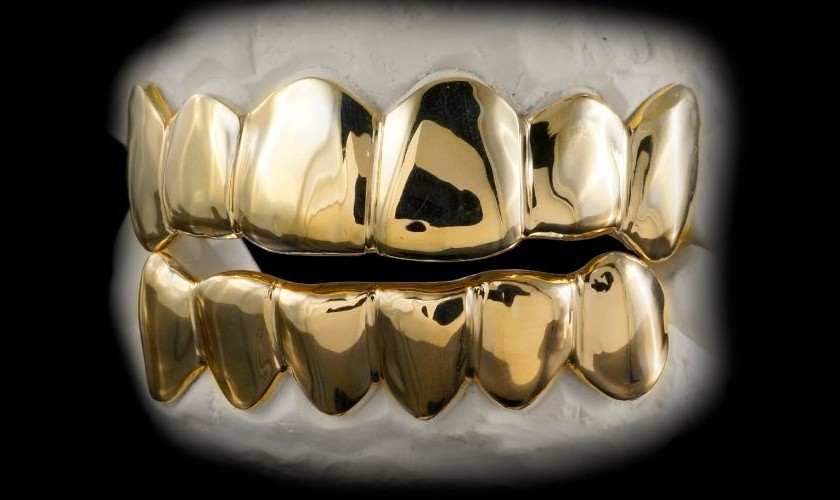 Răng vàng khá “kén” người sử dụng