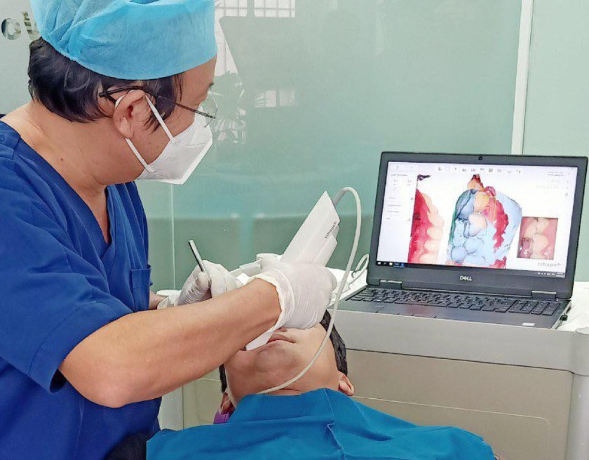 Lấy dấu răng bằng công nghệ 3Shape 3D