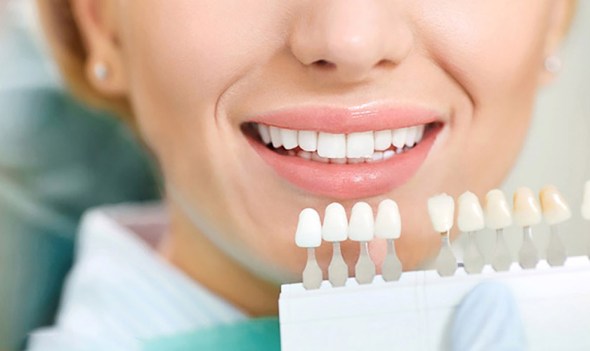 Quy trình đo tông màu răng cần tiến hành theo tiêu chuẩn Y khoa