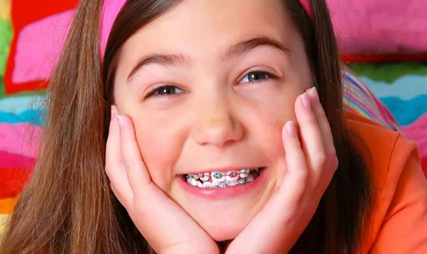 Từ 9-12 tuổi được xem là độ tuổi niềng răng tốt nhất