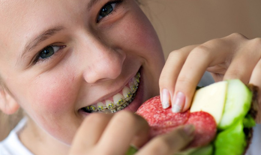 Xây dựng chế độ ăn uống hợp lý khi điều trị chỉnh nha