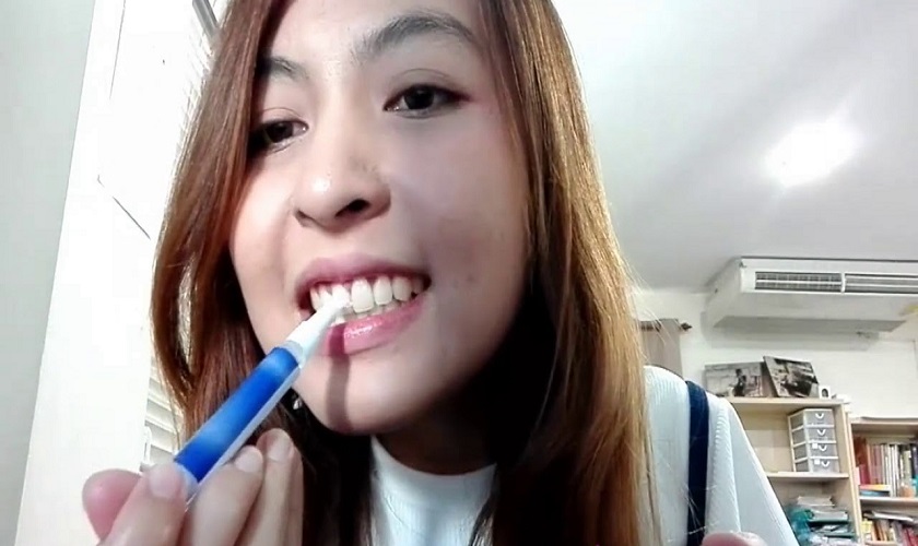 Bút làm trắng răng cho phép người dùng tùy chọn răng cần tẩy
