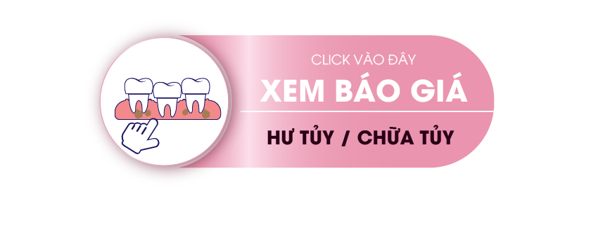 Bảng giá điều trị tủy