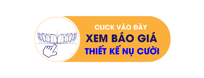 Bảng giá niềng răng