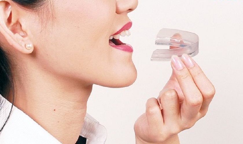 Nên sử dụng máng chống nghiến nếu bạn bị nghiến răng khi ngủ