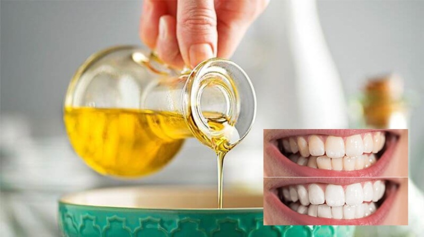 Cách cạo vôi răng với dầu oliu