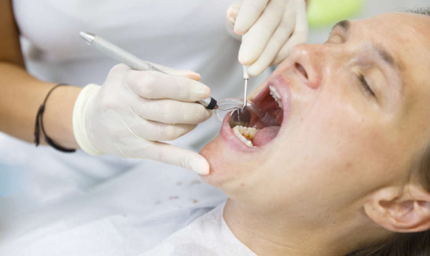 Cạo vôi răng không hề gây đau nhức