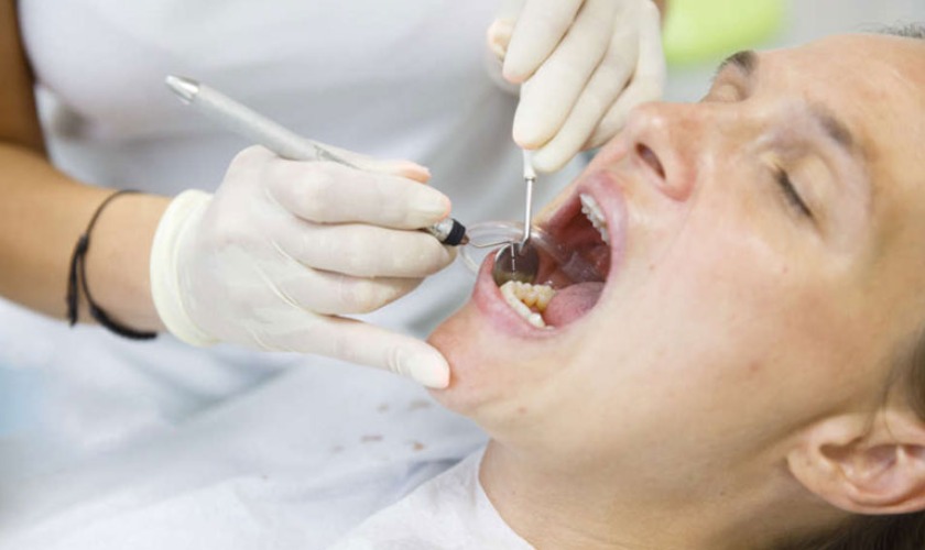 Cần lựa chọn nha khoa uy tín để thực hiện cạo vôi răng