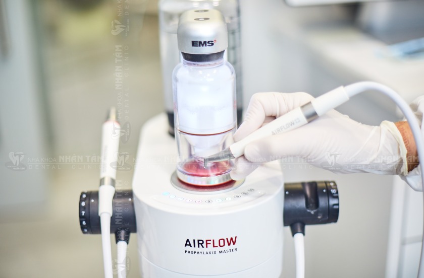 Công nghệ Airflow mang đến nhiều ưu điểm vượt trội