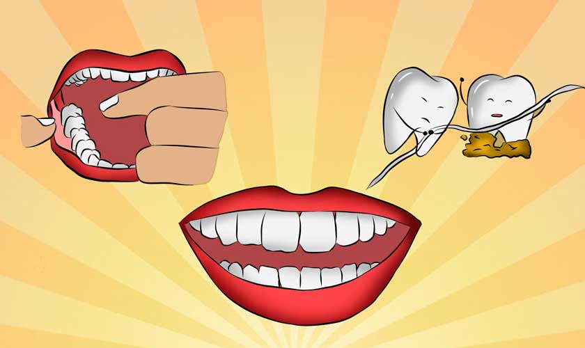 Có nên đi cạo vôi răng không? 