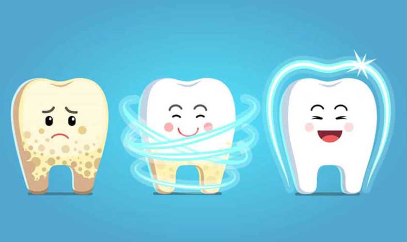 Sau khi cạo vôi răng, răng sẽ trở nên chắc khỏe và sáng màu hơn