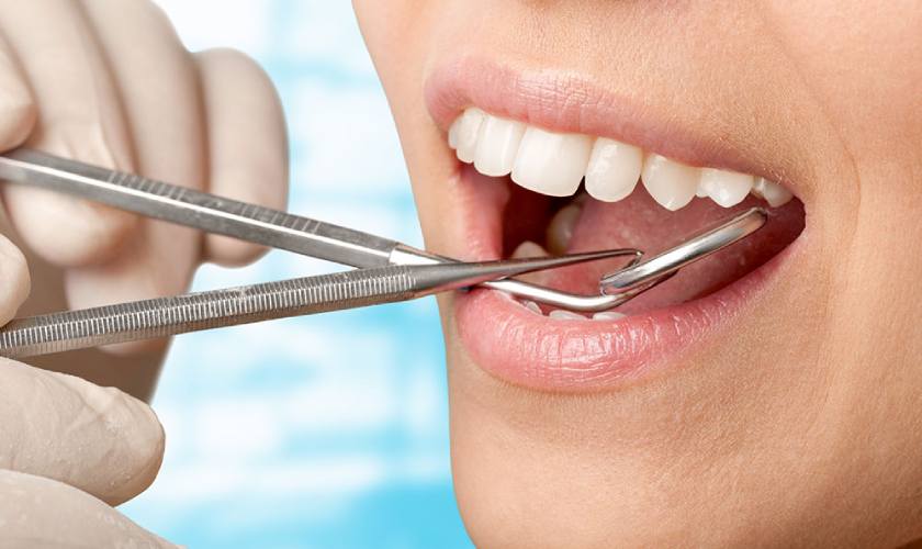 Hàm răng chắc khỏe và thẩm mỹ sau khi cạo vôi răng Hàm răng chắc khỏe và thẩm mỹ sau khi cạo vôi răng