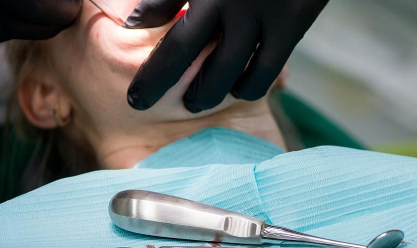 Quá trình cắt chỉ sau nhổ răng khôn diễn ra nhanh chóng và không gây đau