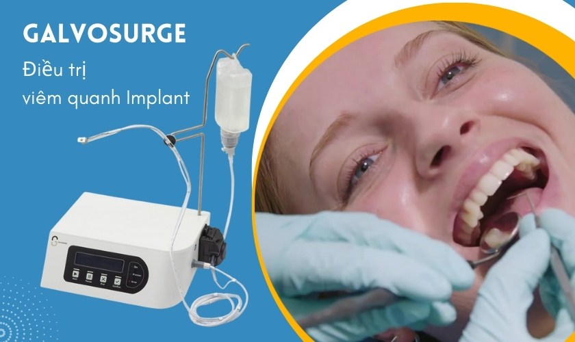 Các trường hợp lâm sàng ứng dụng GalvoSurge hiệu quả