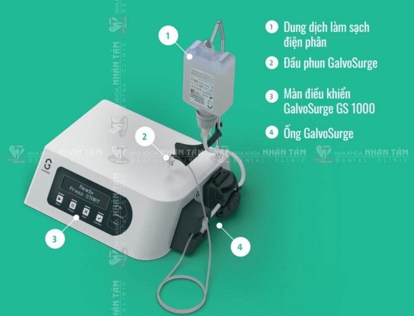 Hệ thống GalvoSurge giúp điều trị viêm quanh Implant hiệu quả Hệ thống GalvoSurge giúp điều trị viêm quanh Implant hiệu quả