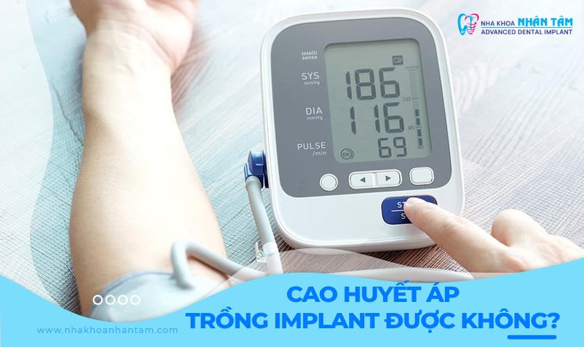 Hình: Cao huyết áp trồng Implant được không? Chuyên gia giải đáp