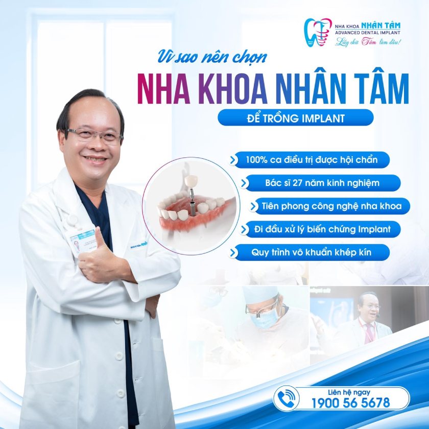 Nha khoa Nhân Tâm là địa chỉ cấy ghép Implant uy tín