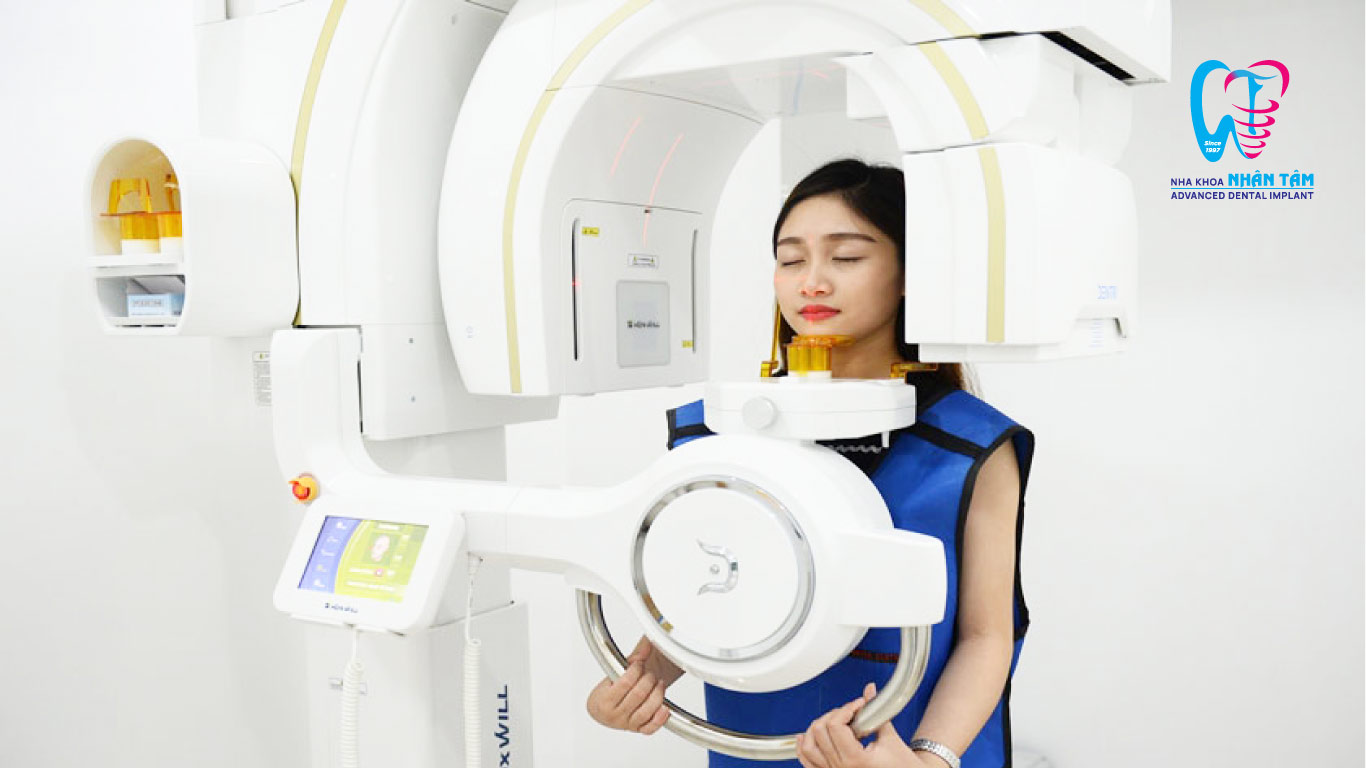 Chụp phim CT là bước quan trọng trong quy trình cấy ghép Implant
