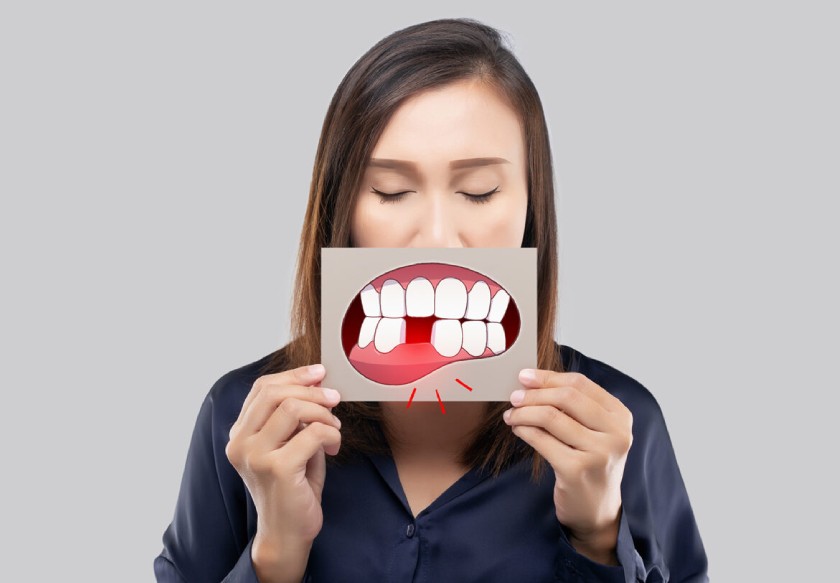 Mất răng khiến nhiều người mất tự tin trong giao tiếp