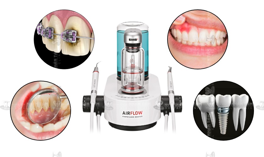 Công nghệ Airflow Prophylaxis được ứng dụng trong nhiều trường hợp