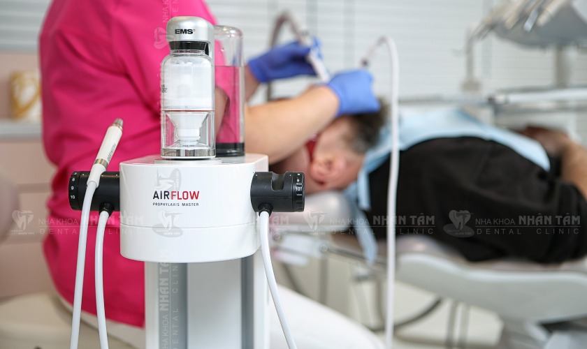 Loại bỏ mảng bám, vôi răng mới hình thành bằng Airflow